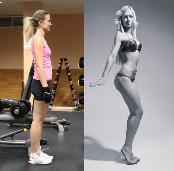 înainte și după mărirea sânilor prin corectarea posturii